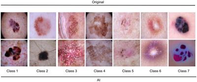 Finetuning of GLIDE stable diffusion model for AI-based text-conditional image synthesis of dermoscopic images